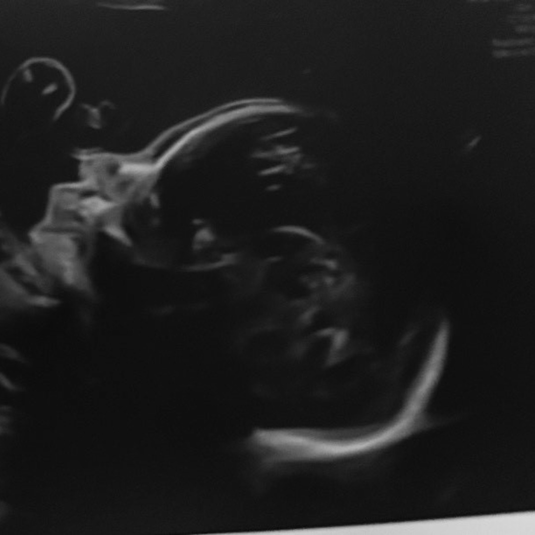 Photo shared by Yajaira for their Babylist baby registry.