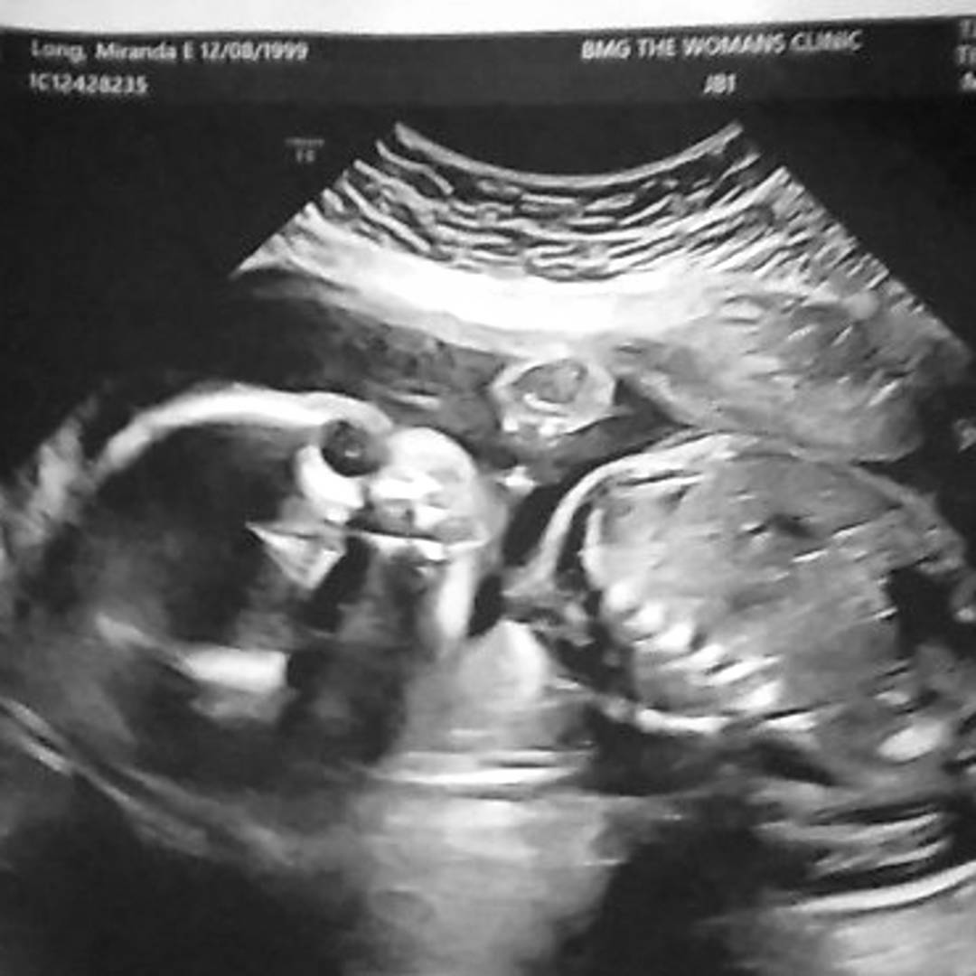 Photo shared by Miranda for their Babylist baby registry.