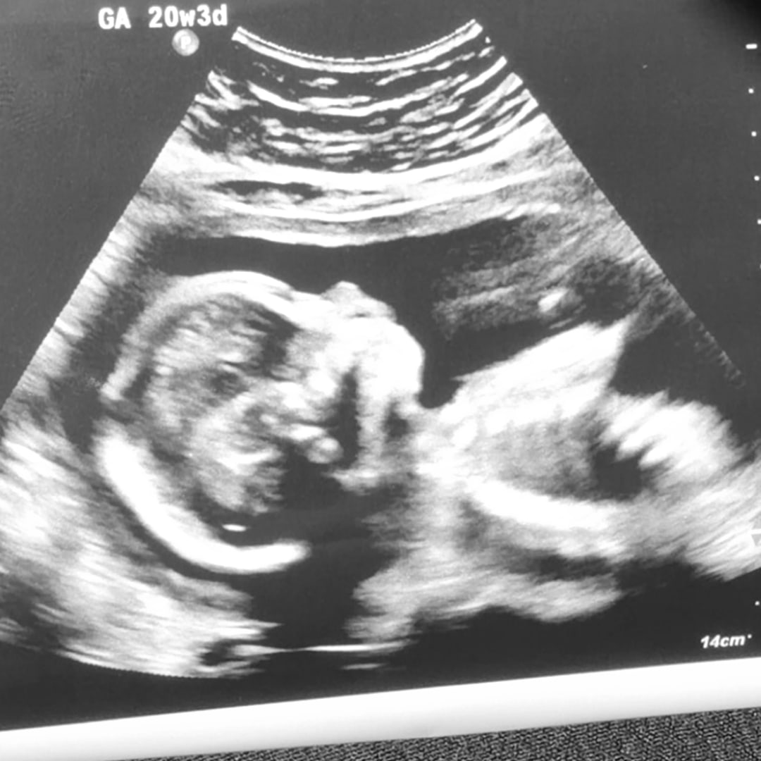 Photo shared by Marlene for their Babylist baby registry.
