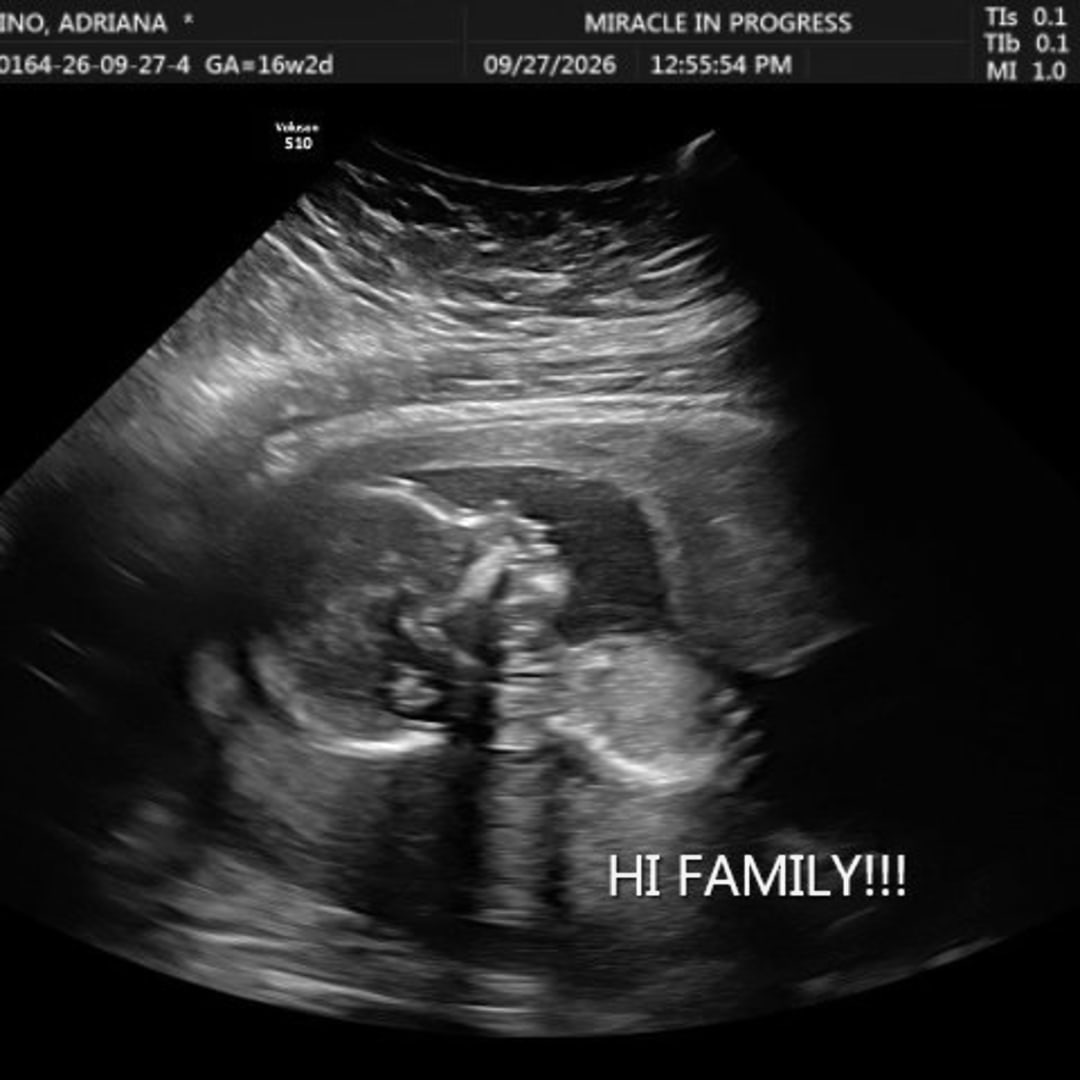Photo shared by Adriana for their Babylist baby registry.