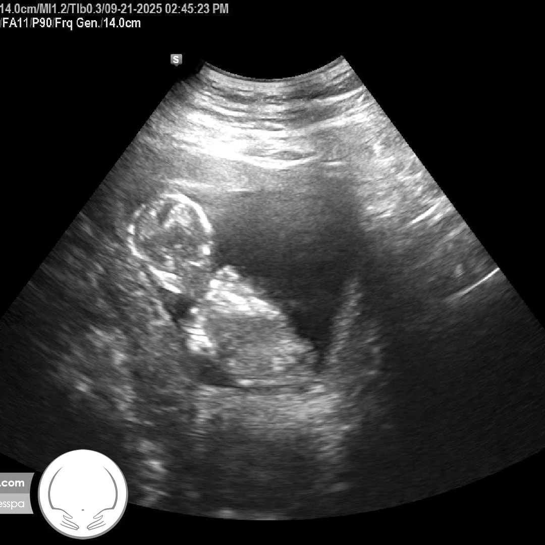 Photo shared by Sonia for their Babylist baby registry.