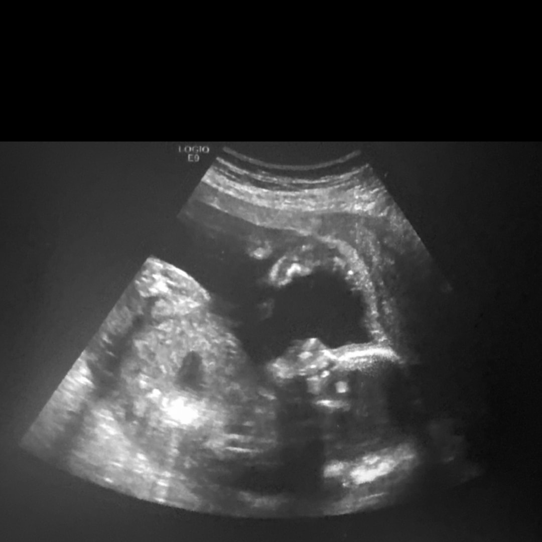 Photo shared by Lauren for their Babylist baby registry.