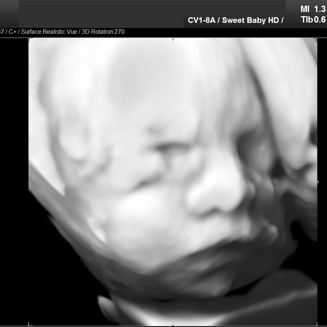 Photo shared by Ashley for their Babylist baby registry.