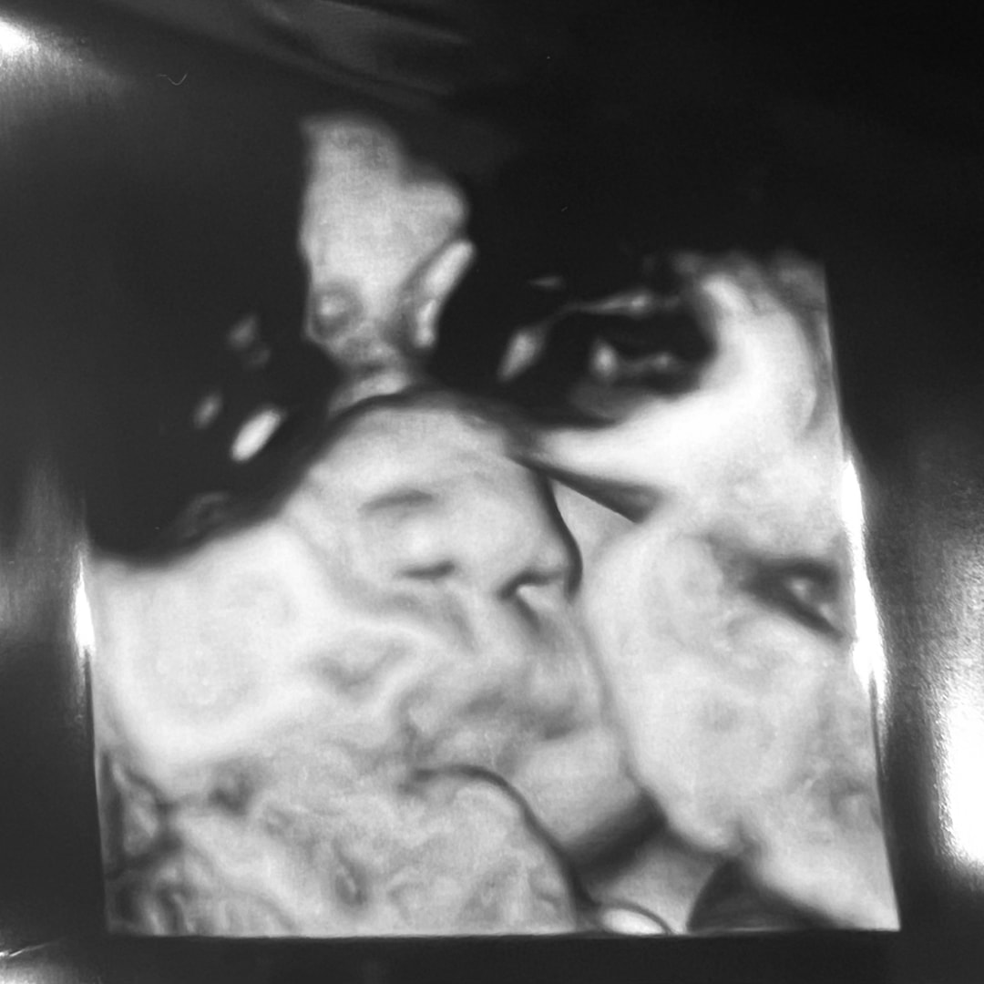 Photo shared by Brittany for their Babylist baby registry.