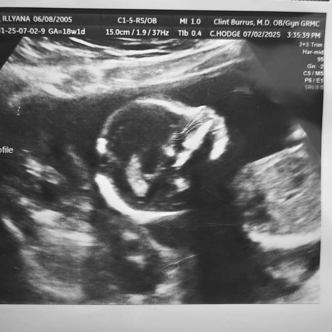 Photo shared by Illyana for their Babylist baby registry.