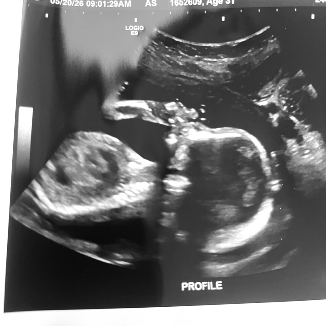 Photo shared by Patience for their Babylist baby registry.