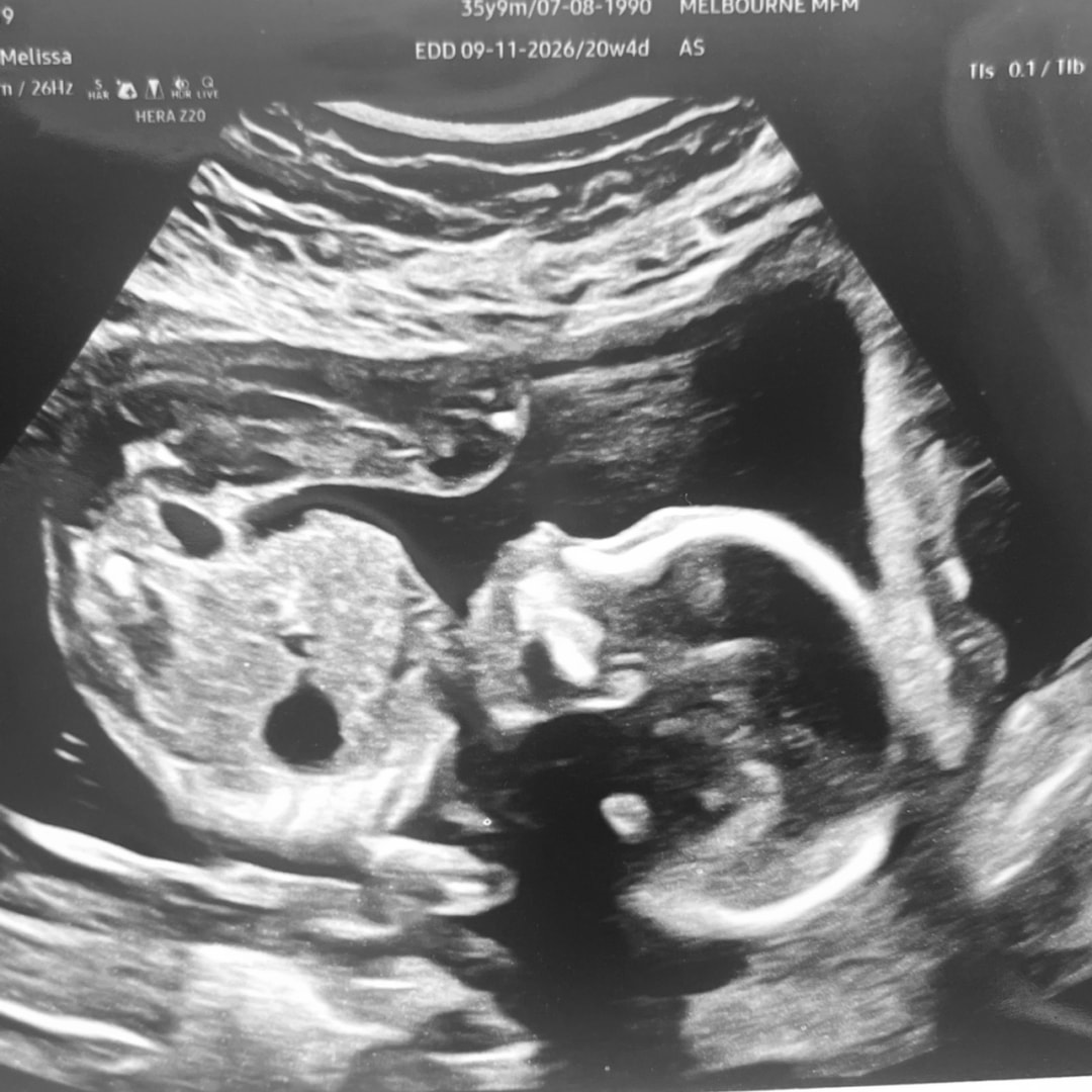 Photo shared by Melissa for their Babylist baby registry.