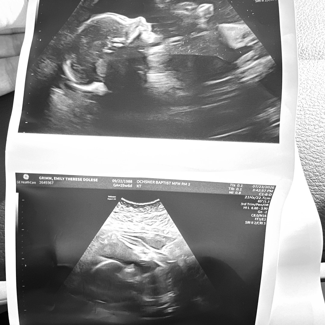 Photo shared by Emily for their Babylist baby registry.
