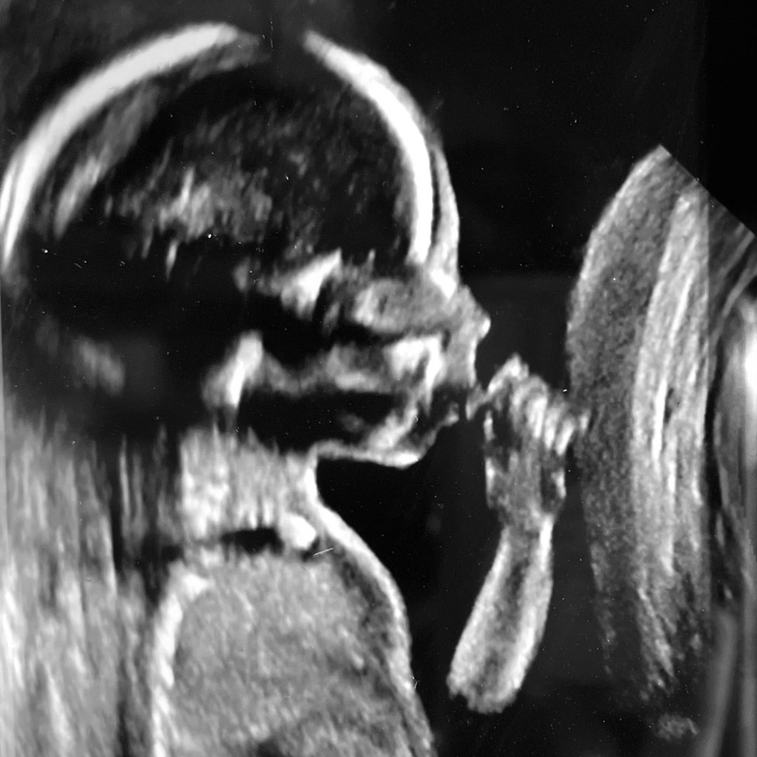 Photo shared by Hannah for their Babylist baby registry.