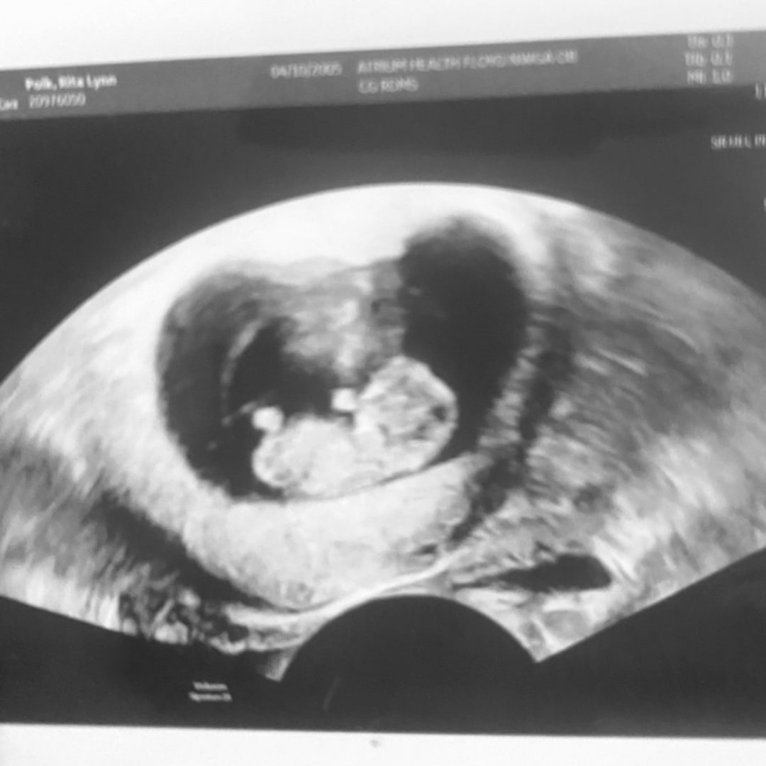 Photo shared by Rita for their Babylist baby registry.