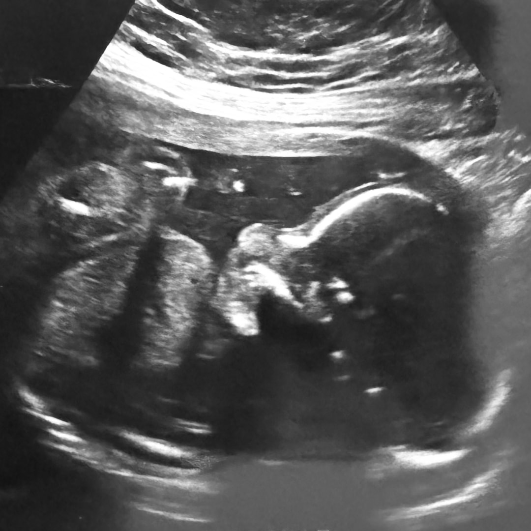 Photo shared by Abigail for their Babylist baby registry.