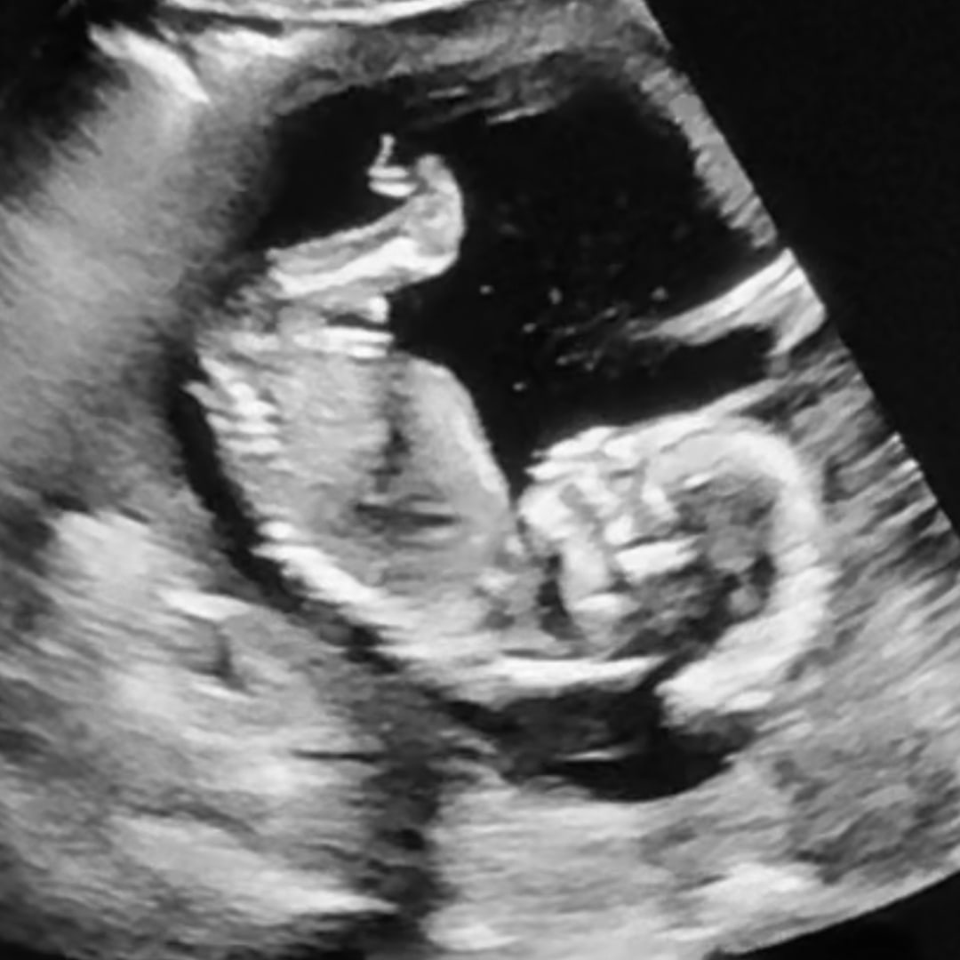 Photo shared by Baylee for their Babylist baby registry.
