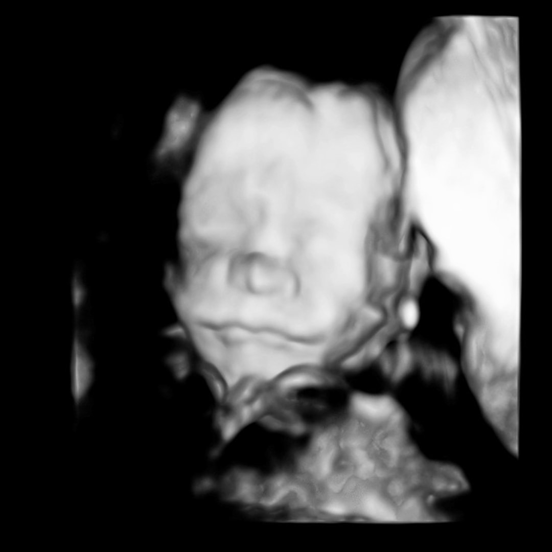 Photo shared by Madison for their Babylist baby registry.