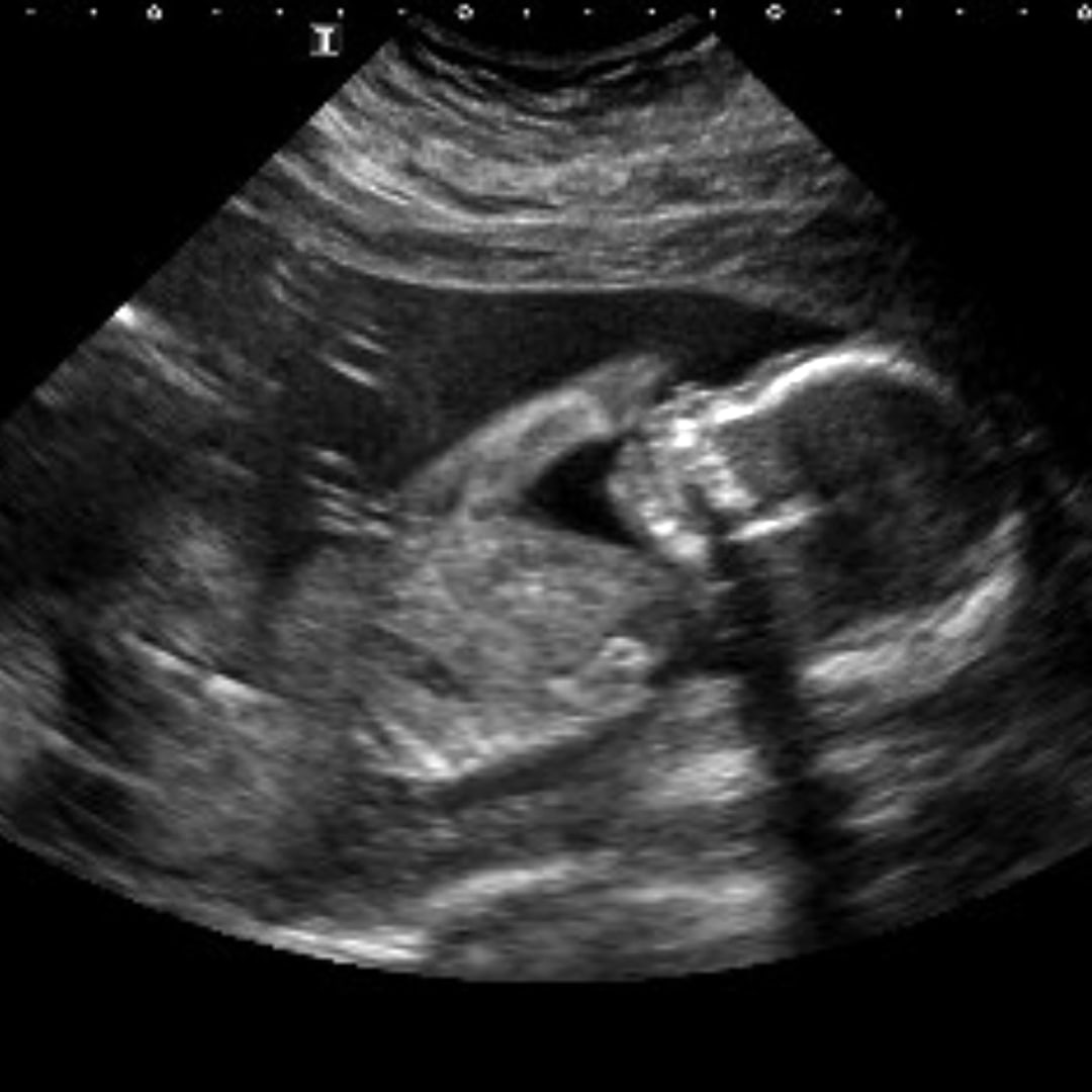 Photo shared by Ariana for their Babylist baby registry.