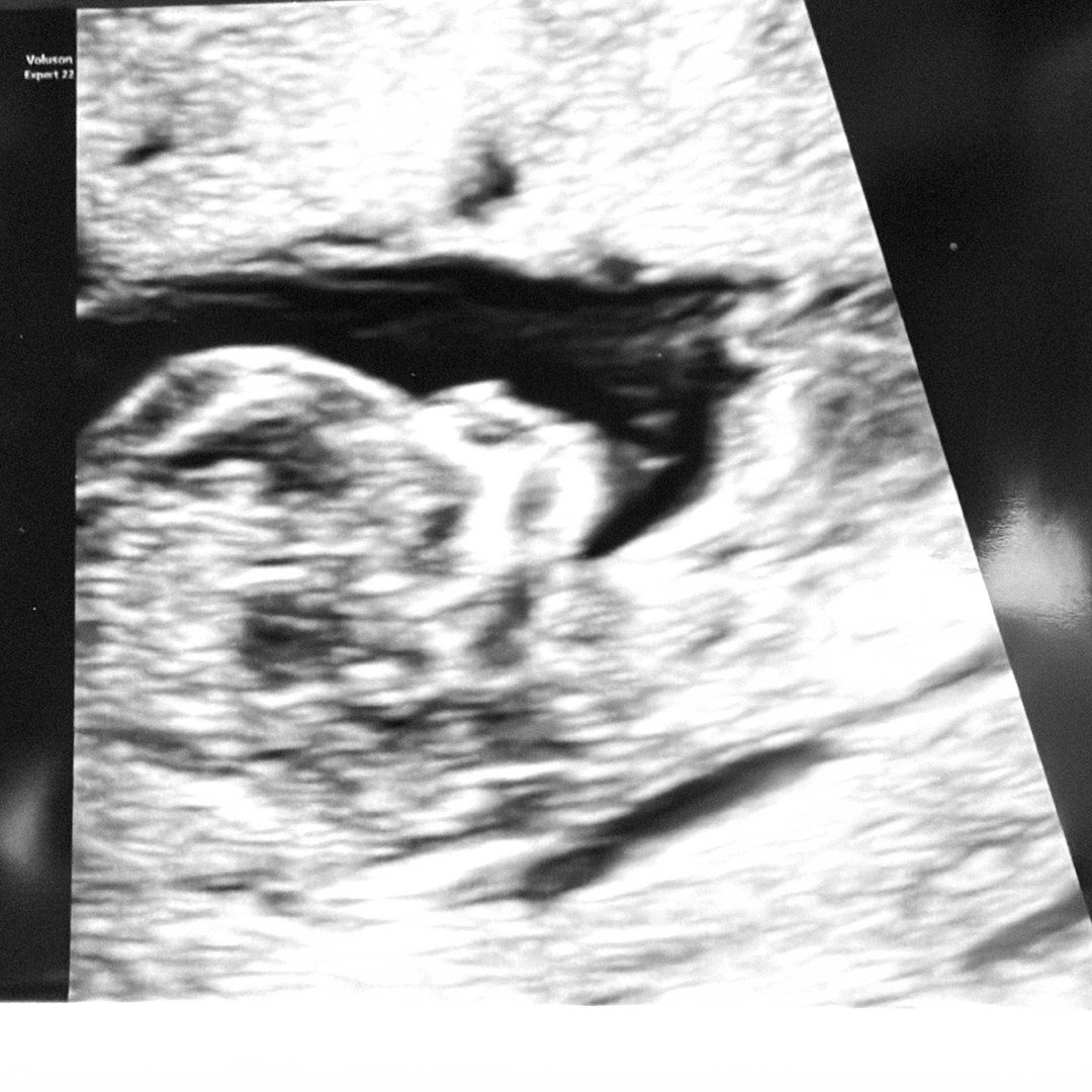 Photo shared by Juanita for their Babylist baby registry.