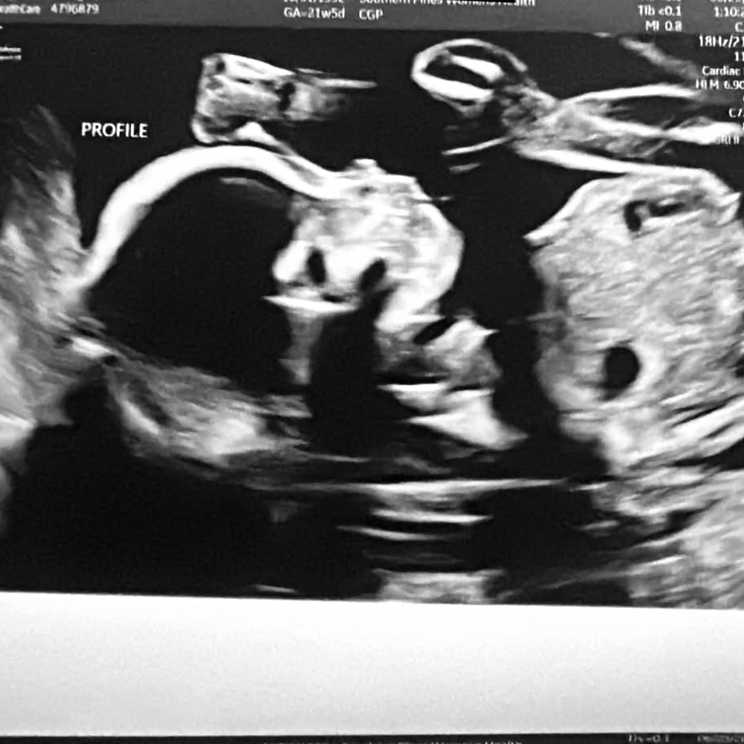 Photo shared by Natalie for their Babylist baby registry.