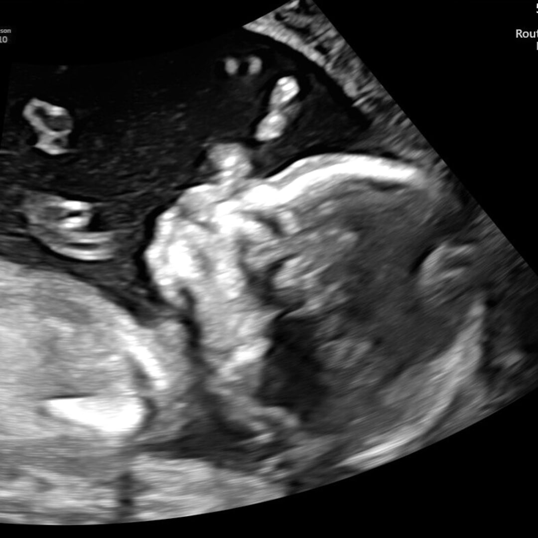 Photo shared by Geniva for their Babylist baby registry.