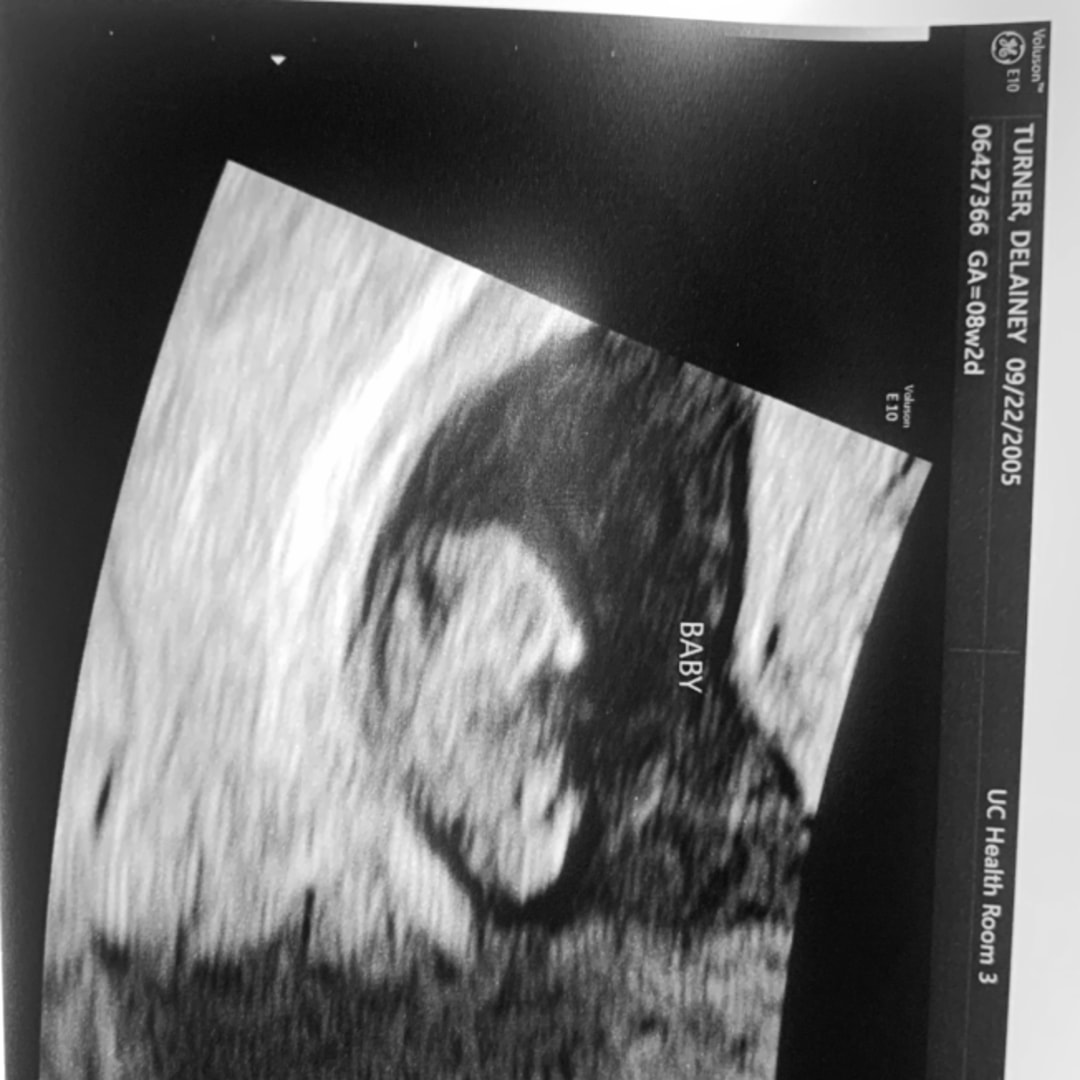 Photo shared by Delainey for their Babylist baby registry.