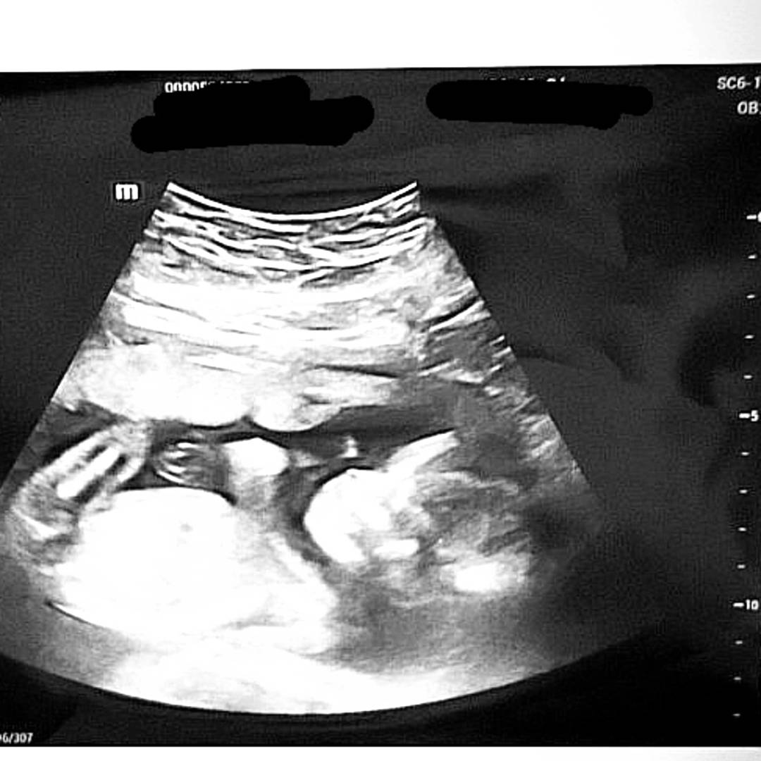 Photo shared by Brynn for their Babylist baby registry.