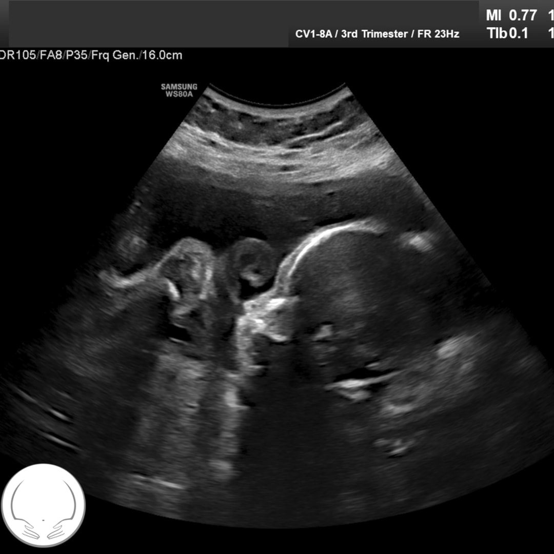 Photo shared by Allison for their Babylist baby registry.