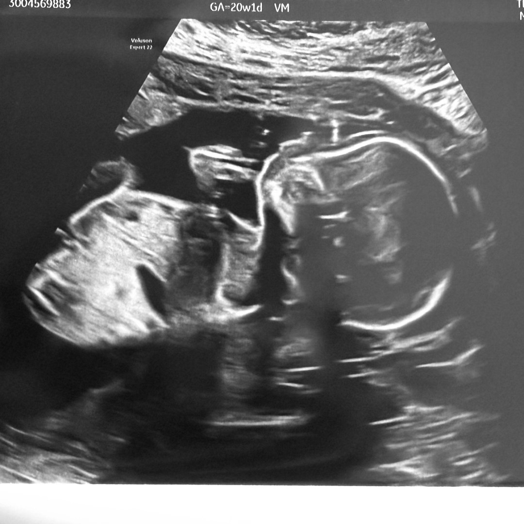 Photo shared by Celina for their Babylist baby registry.