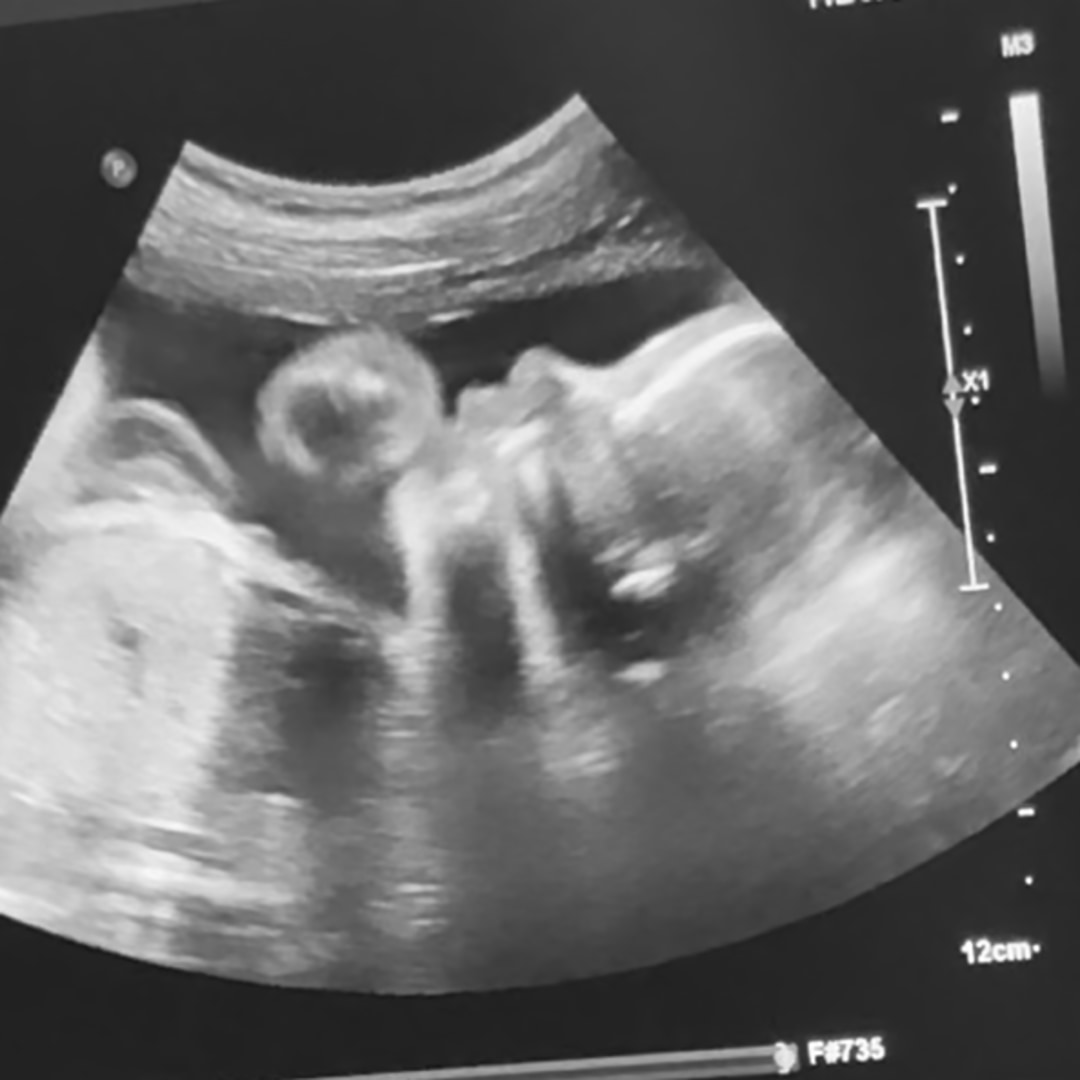 Photo shared by Amiah for their Babylist baby registry.