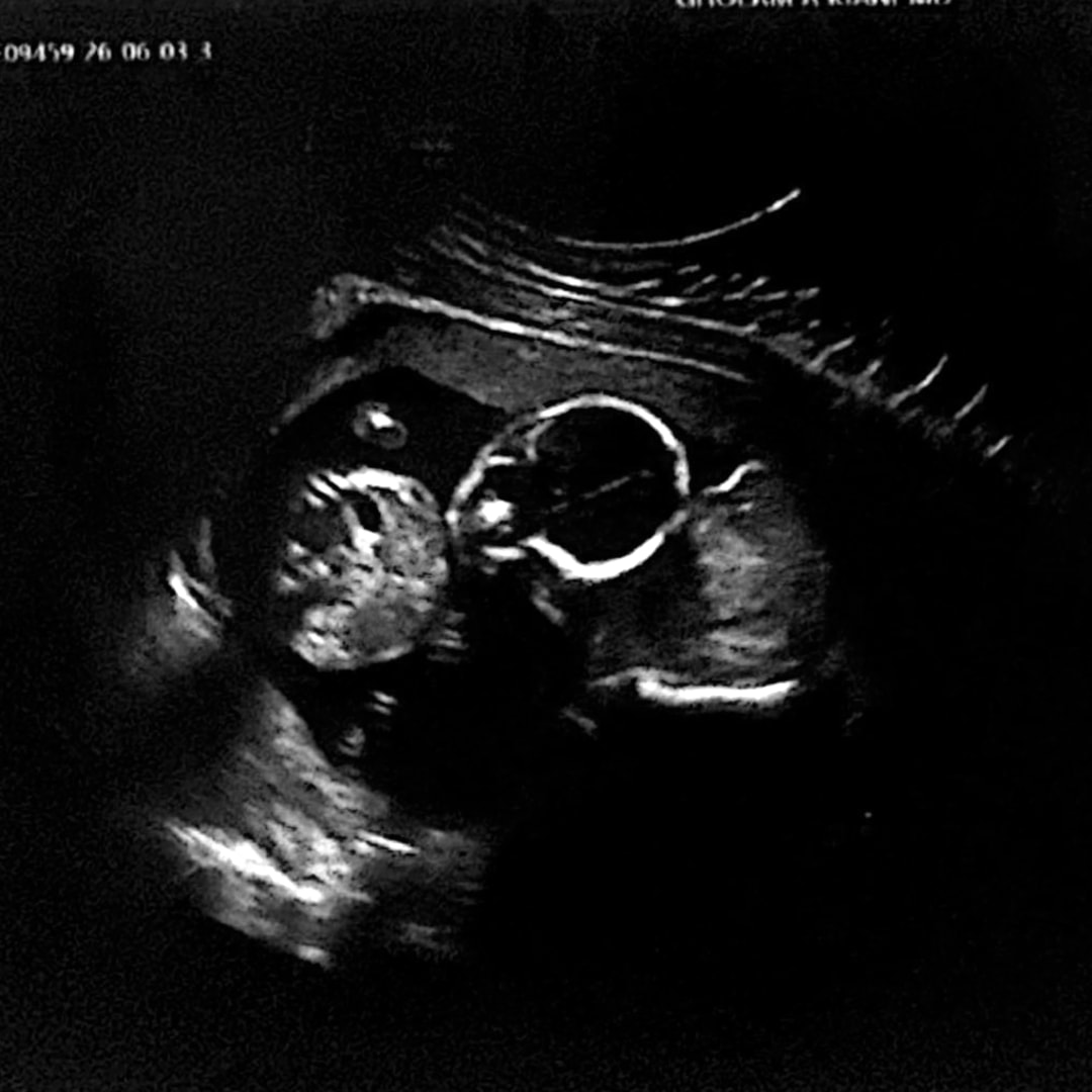 Photo shared by Karla for their Babylist baby registry.