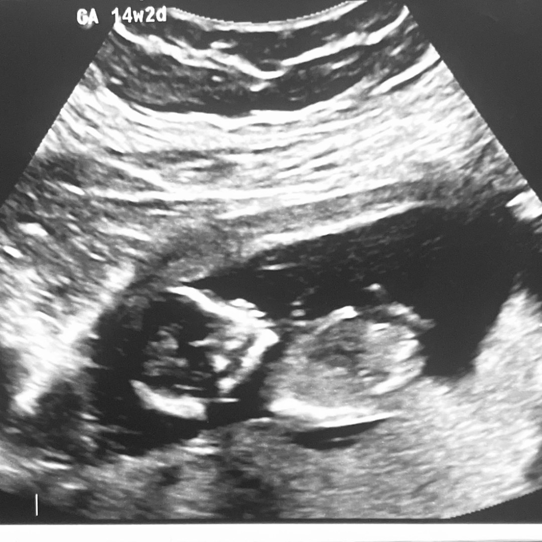 Photo shared by Hailie for their Babylist baby registry.