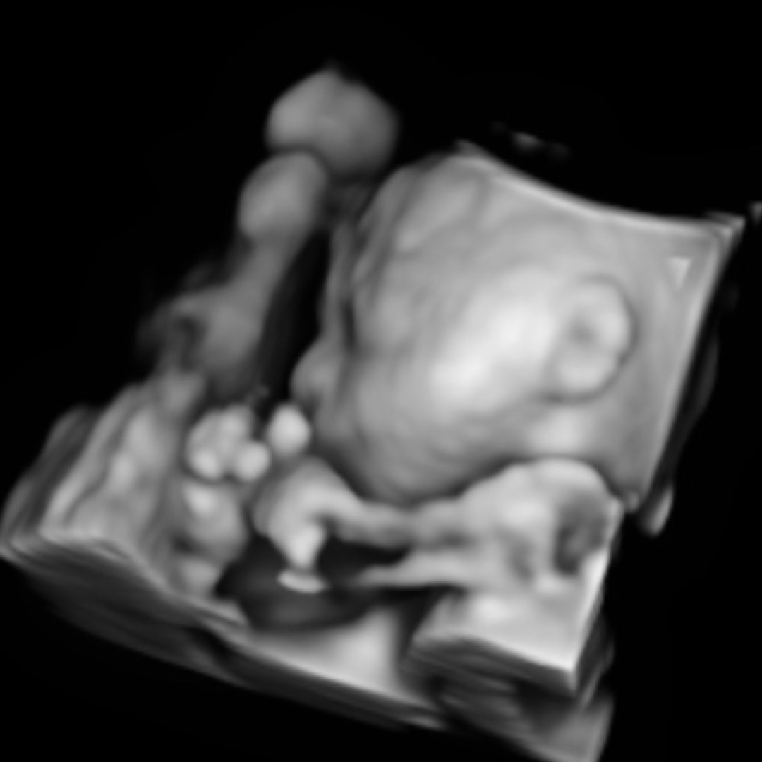 Photo shared by Savannah for their Babylist baby registry.