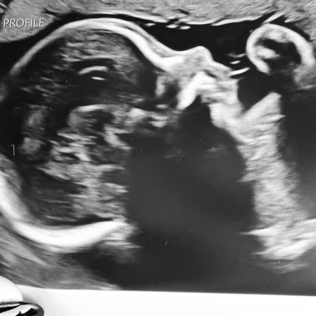 Photo shared by Dana for their Babylist baby registry.