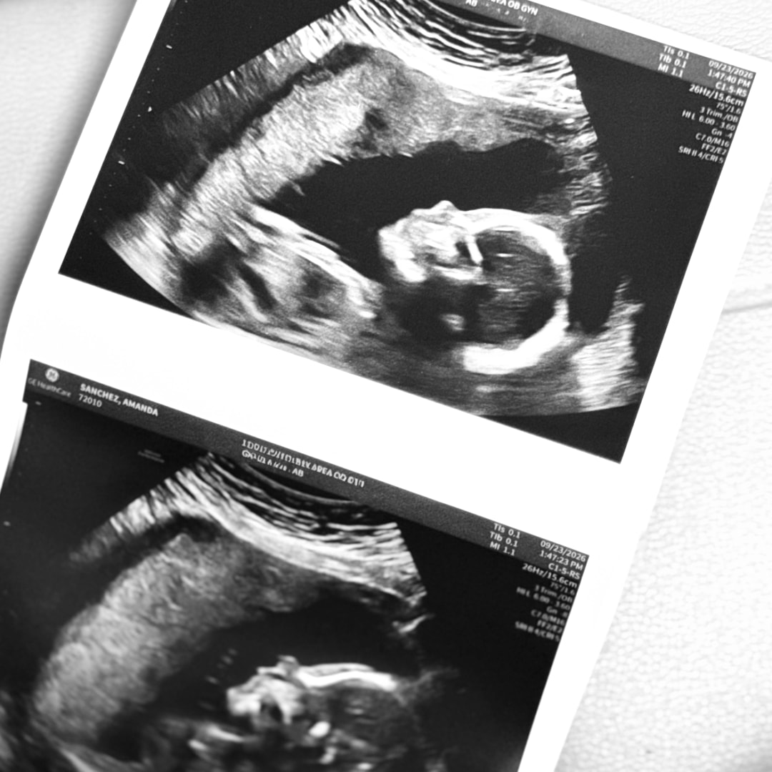 Photo shared by Amanda for their Babylist baby registry.