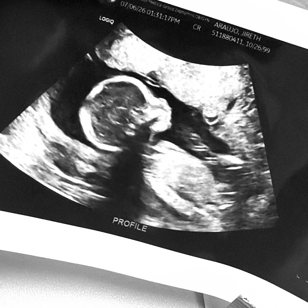 Photo shared by Jireth for their Babylist baby registry.