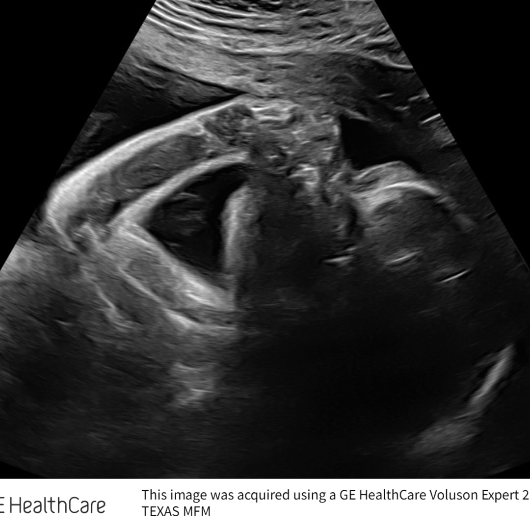 Photo shared by Bella for their Babylist baby registry.