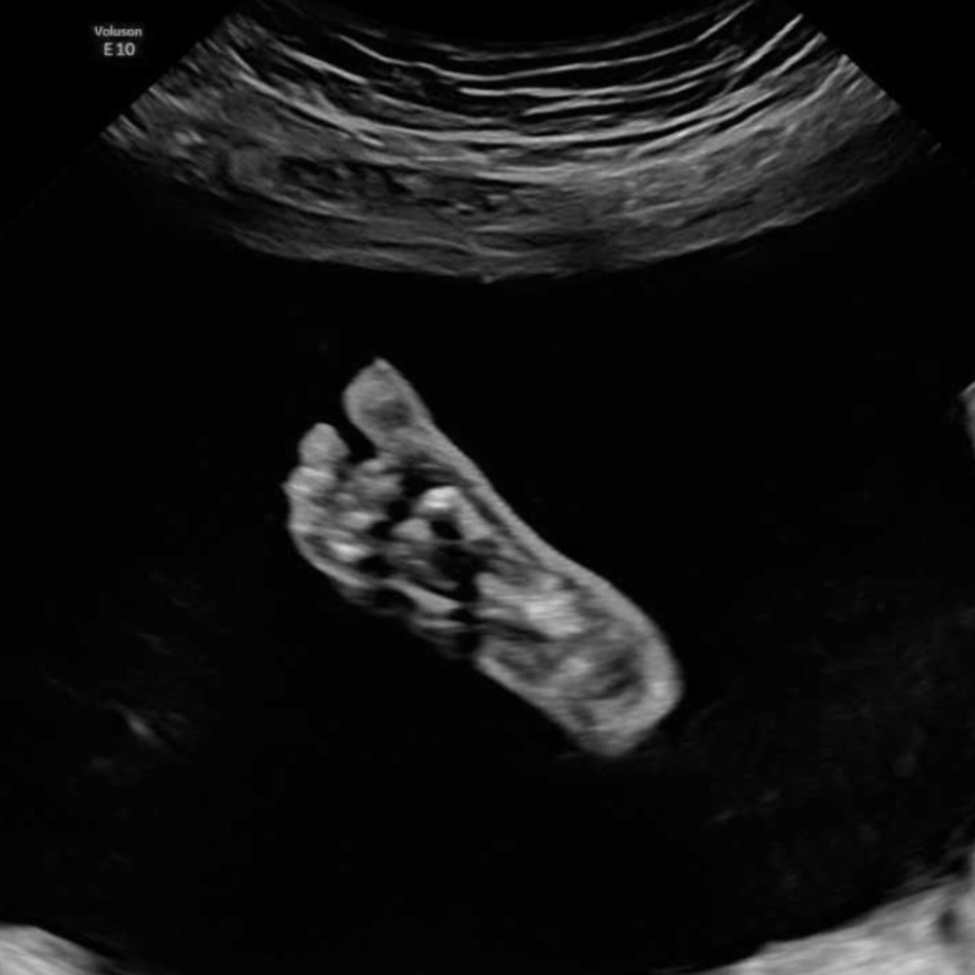 Photo shared by Adia for their Babylist baby registry.