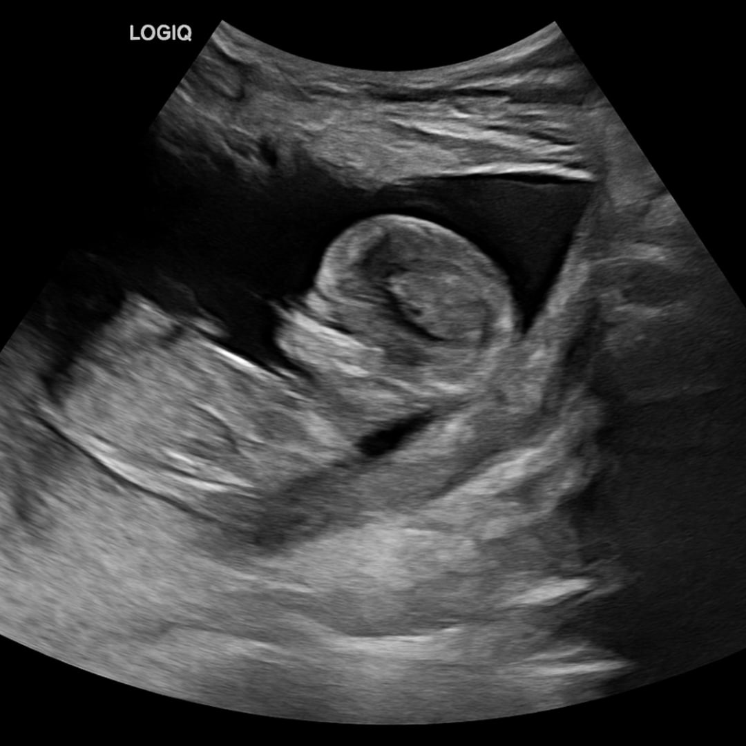 Photo shared by Bethany for their Babylist baby registry.