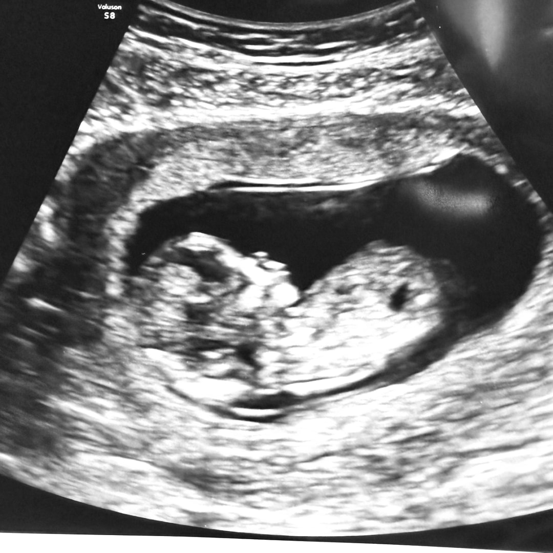 Photo shared by Madison for their Babylist baby registry.