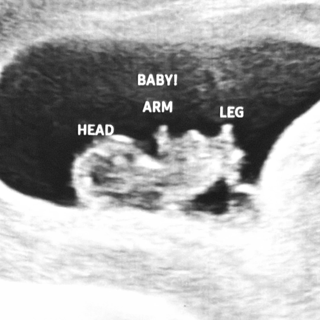 Photo shared by Daphne for their Babylist baby registry.