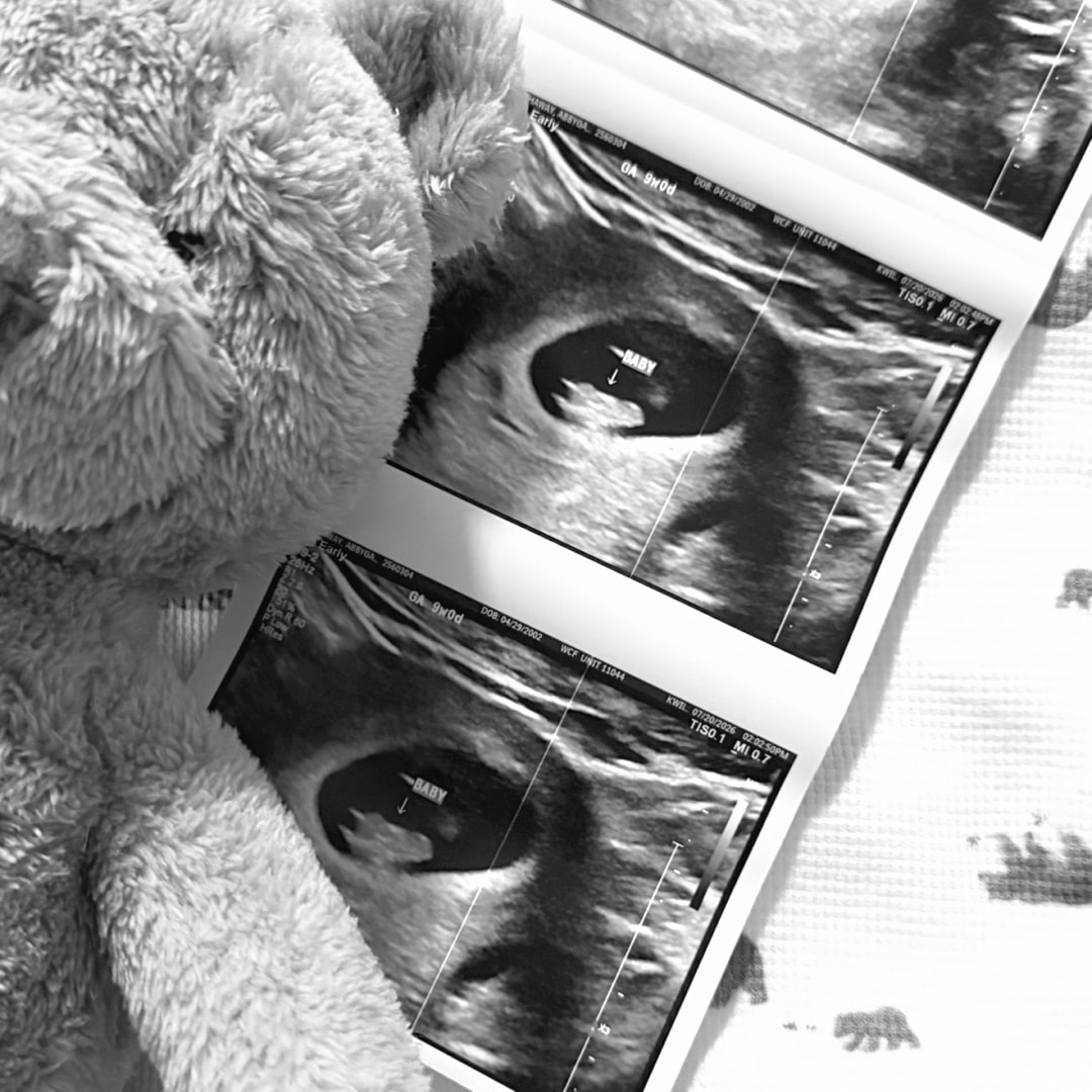 Photo shared by Abbygale for their Babylist baby registry.