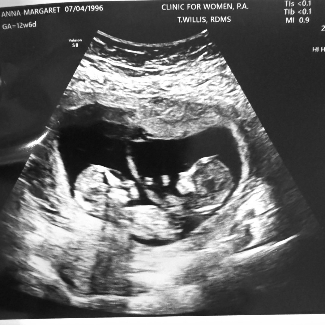 Photo shared by Anna-Margaret for their Babylist baby registry.