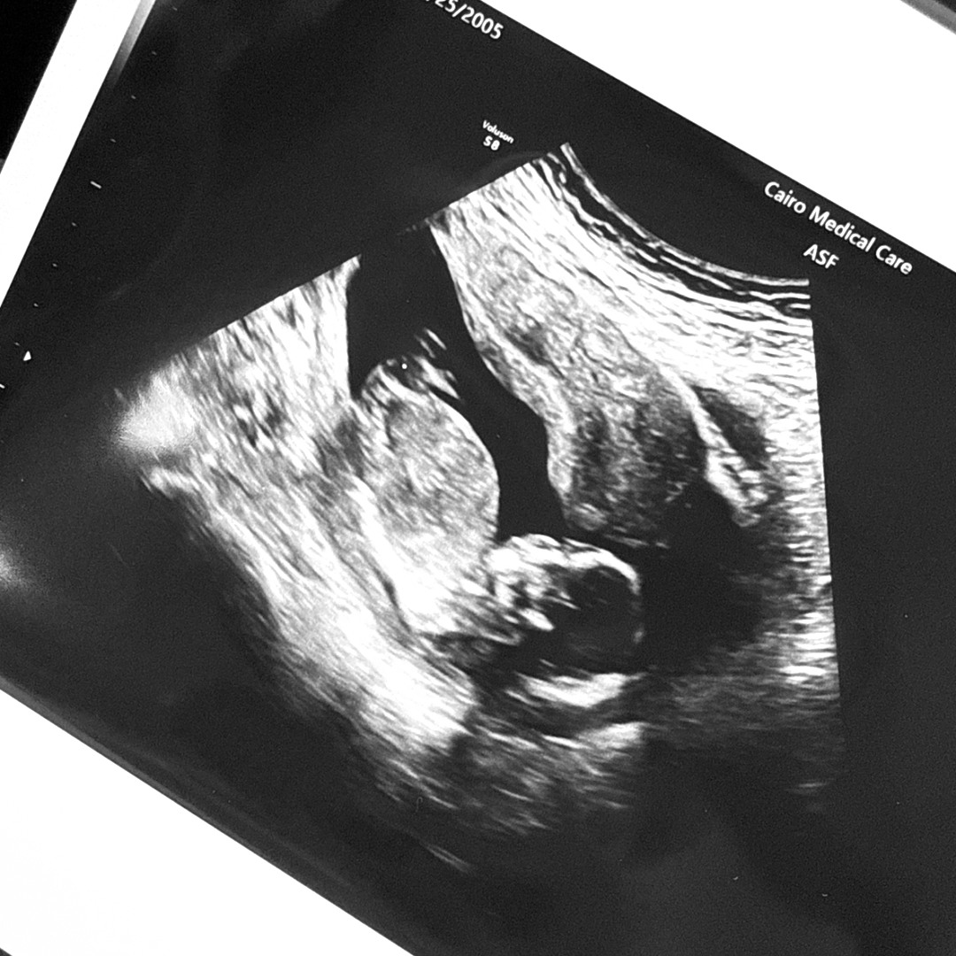 Photo shared by Amy for their Babylist baby registry.