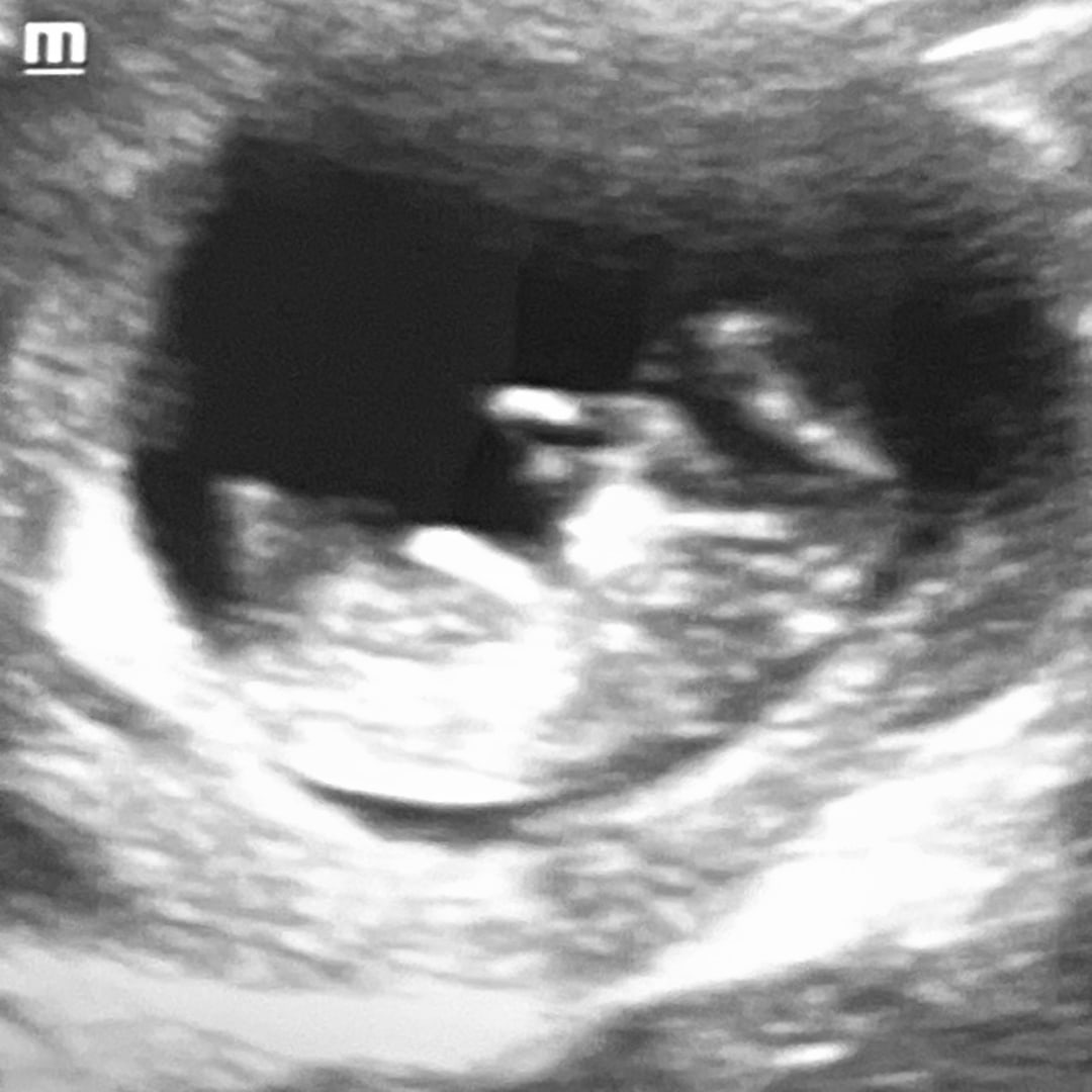 Photo shared by Lacy for their Babylist baby registry.