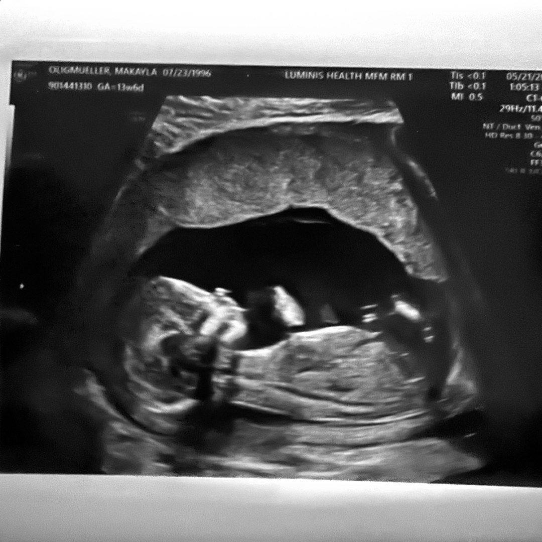 Photo shared by Makayla for their Babylist baby registry.