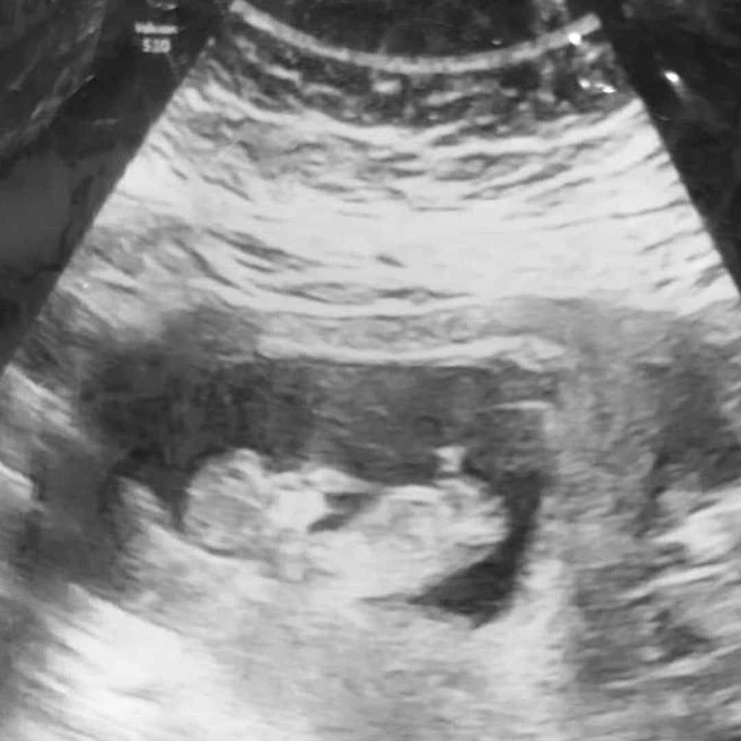 Photo shared by Brittany for their Babylist baby registry.