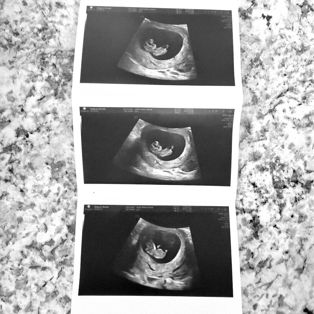 Photo shared by Miranda for their Babylist baby registry.
