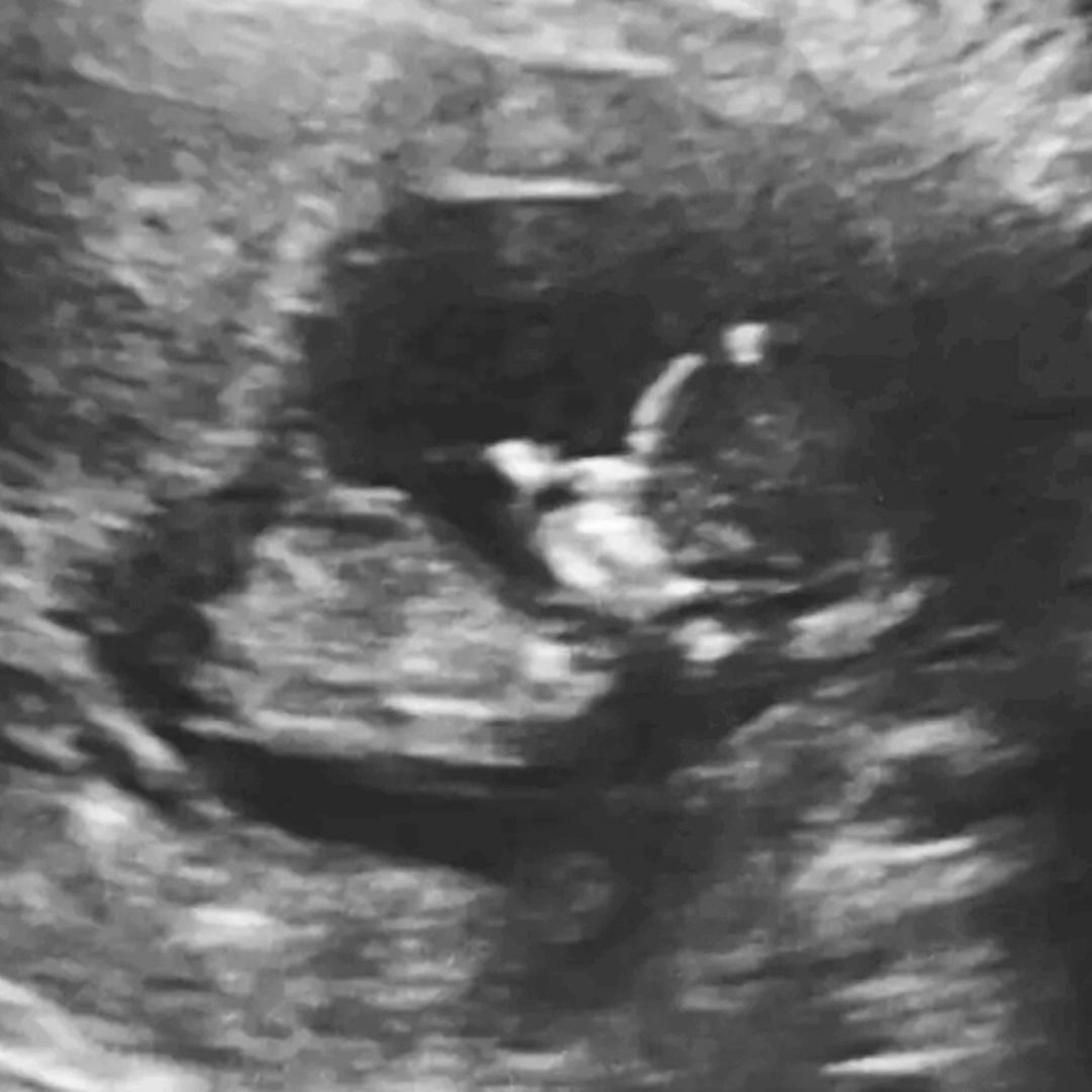 Photo shared by Suzan for their Babylist baby registry.