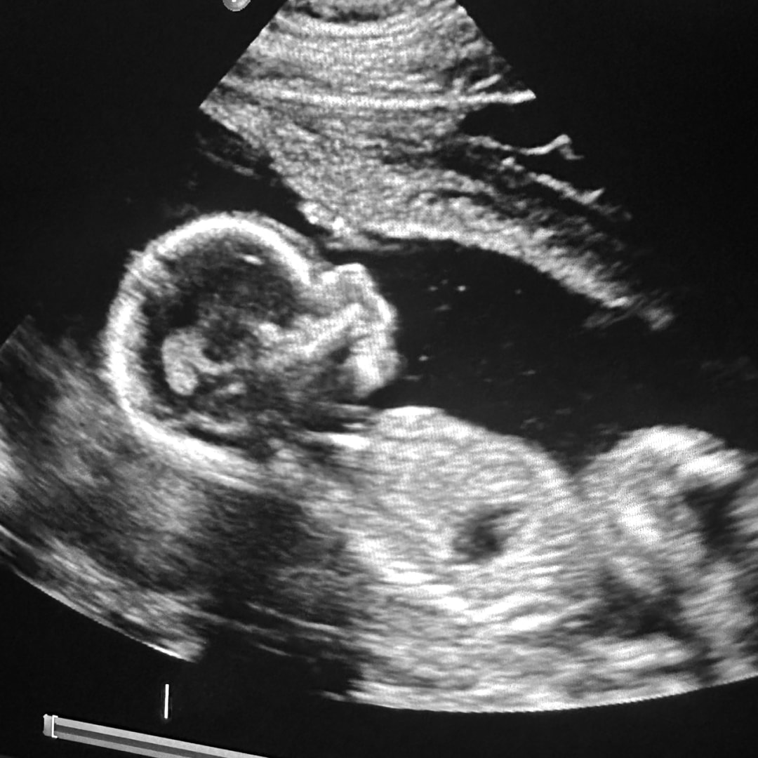 Photo shared by Katie for their Babylist baby registry.