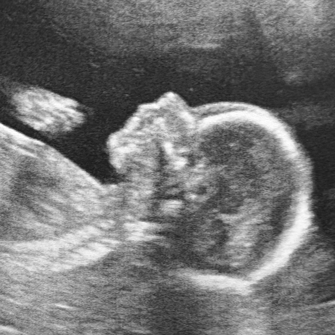 Photo shared by Amy for their Babylist baby registry.