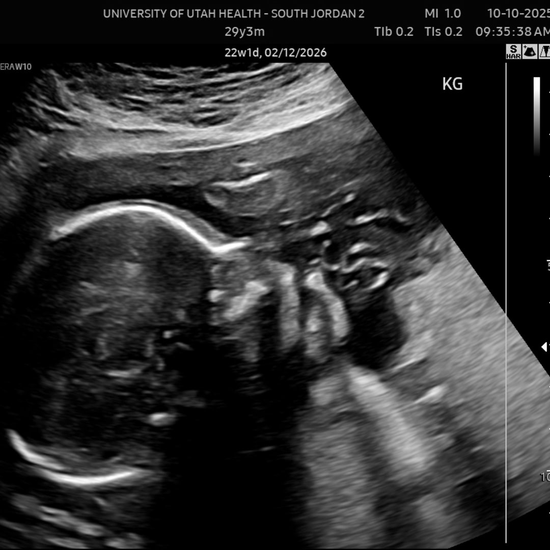 Photo shared by Alexis for their Babylist baby registry.