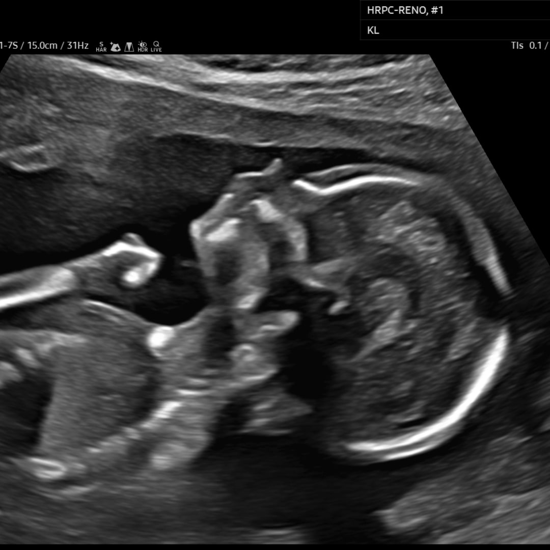 Photo shared by Alexis for their Babylist baby registry.