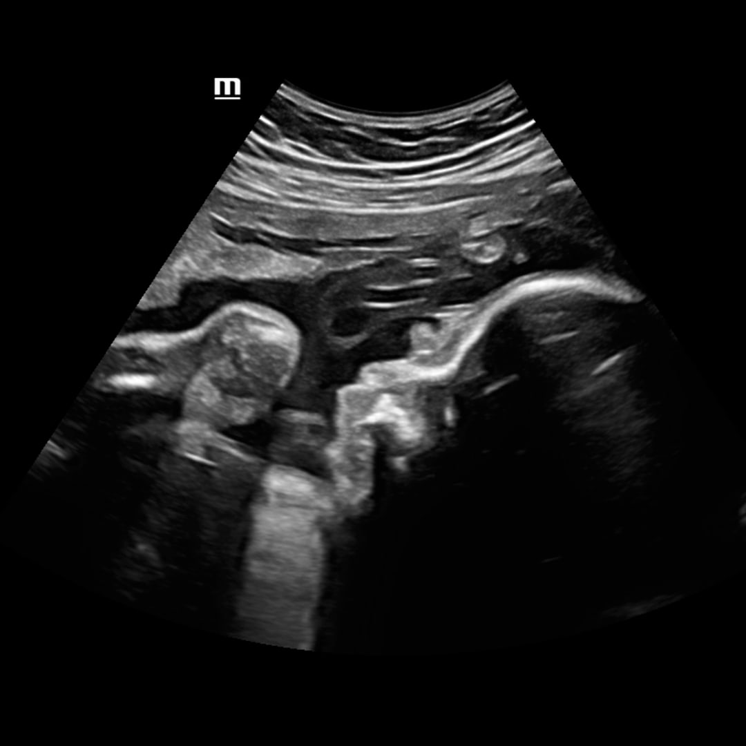 Photo shared by Yulim for their Babylist baby registry.